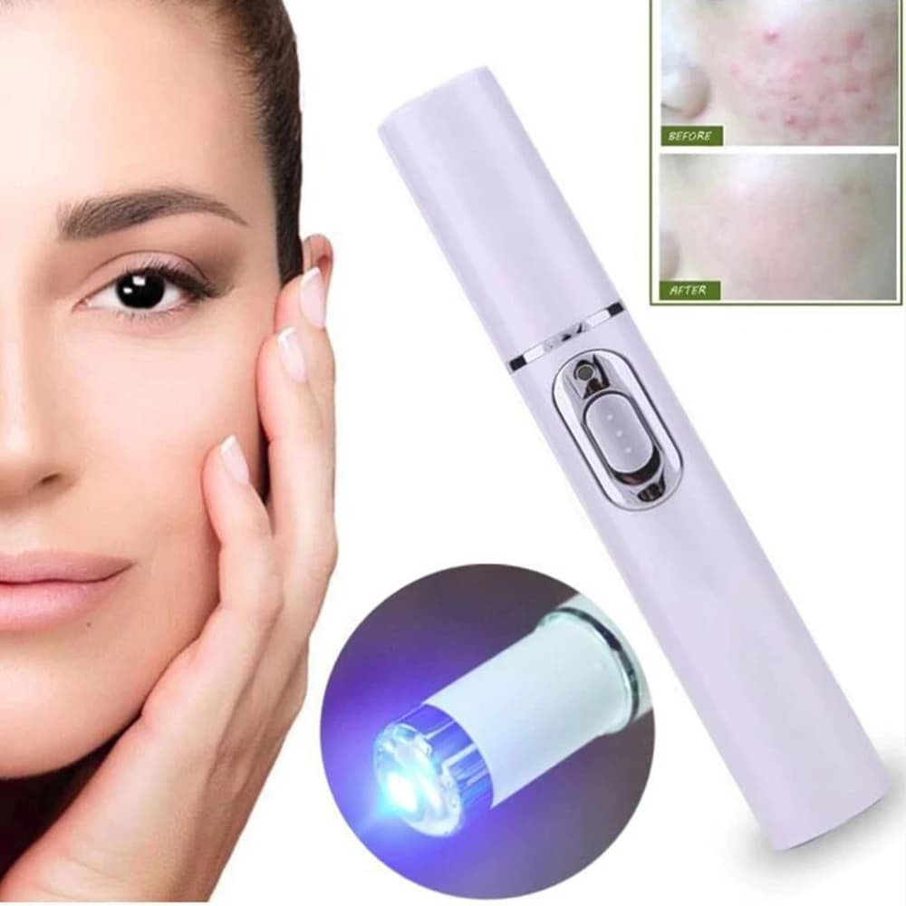 Portable Acne Laser Pen for Wrinkles, Skin Spots, Spider Vein Removal, Blue Light Therapy - Samlox ABS Plastic Hot